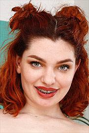 Brace Face Annabel Redd Smiling